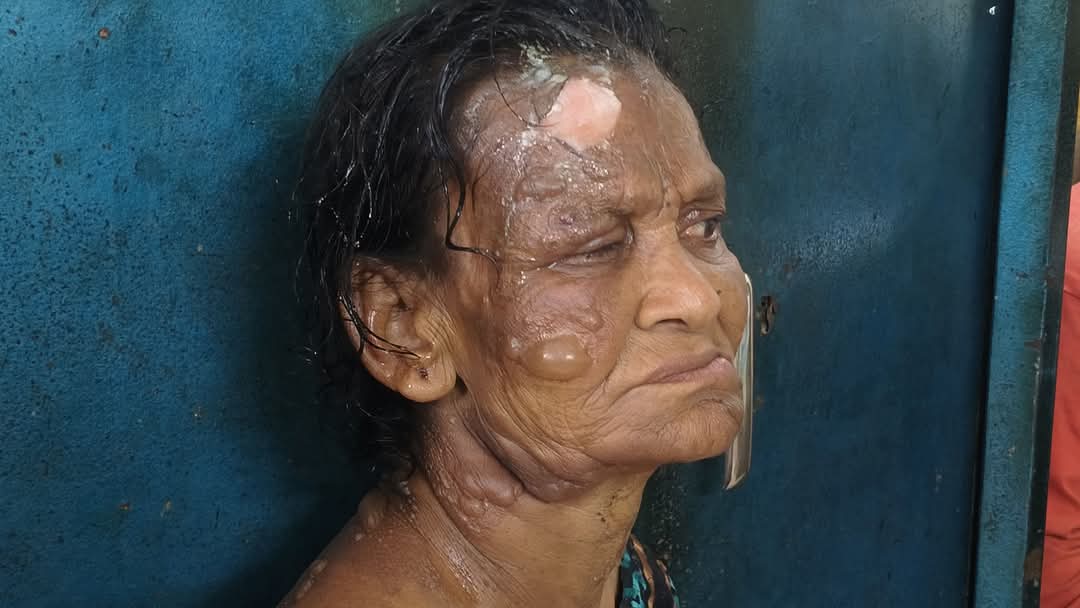 মুরাদনগরে গরম পানিতে বৃদ্ধার শরীর ঝলসে দিল প্রতিবেশি